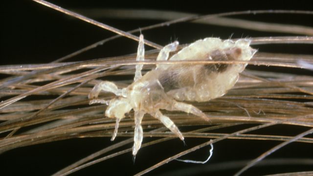 Head Lice Season Returns: What Parents and Educators Need to Know